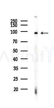 DNMT3B Recombinant Rabbit mAb - Western blot analysis of lysates from Rat spleen, using Dnmt3b Recombinant Rabbit mAb at 1/1000 dilution.