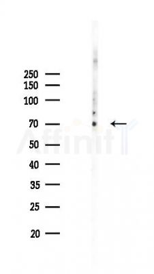NEFL Recombinant Rabbit mAb - Western blot analysis of lysates from COLO205 cells(LPS,4h treatment), using 70 kD Neurofilament Light Recombinant Rabbit mAb at 1/1000 dilution.