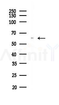 HDAC1 Recombinant Rabbit mAb - Western blot analysis of lysates from Mouse liver, using HDAC1 Recombinant Rabbit mAb at 1/1000 dilution.