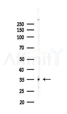 CD80 Recombinant Rabbit mAb - Western blot analysis of lysates from Hela cells(heat-shock,45min treatment), using CD80 Recombinant Rabbit mAb at 1/1000 dilution.