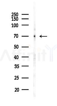 E2F1 Recombinant Rabbit mAb - Western blot analysis of lysates from Mouse liver, using E2F1 Recombinant Rabbit mAb at 1/1000 dilution.