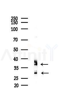 CD83 Recombinant Rabbit mAb - Western blot analysis of lysates from Rat muscle, using CD83 Recombinant Rabbit mAb at 1/1000 dilution.