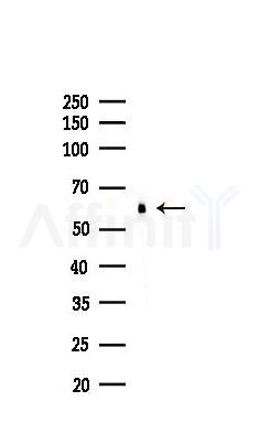 PCSK9 Recombinant Rabbit mAb - Western blot analysis of lysates from Hela cells(heat-shock,45min treatment), using PCSK9 Recombinant Rabbit mAb at 1/1000 dilution.