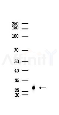 Phospho-p27 Kip1 (Ser10) Recombinant Rabbit mAb - Western blot analysis of lysates from Rat testis, using Phospho-p27 KIP 1 (Ser10) Recombinant Rabbit mAb at 1/1000 dilution.