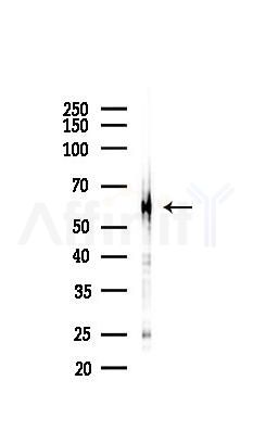 HSP60 Recombinant Rabbit mAb - Western blot analysis of lysates from Mouse liver, using Hsp60 Recombinant Rabbit mAb at 1/1000 dilution.