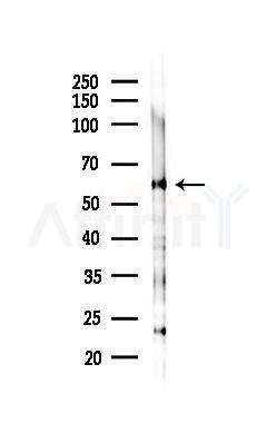 HSP60 Recombinant Rabbit mAb - Western blot analysis of lysates from Rat lung, using Hsp60 Recombinant Rabbit mAb at 1/1000 dilution.