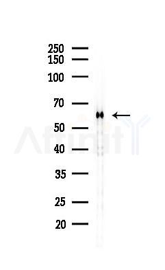 HSP60 Recombinant Rabbit mAb - Western blot analysis of lysates from B16F10-LUC cells(LPS,4h treatment), using Hsp60 Recombinant Rabbit mAb at 1/1000 dilution.