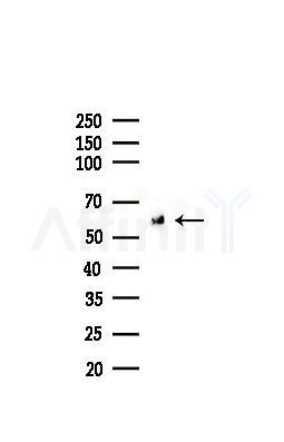 G6PD Recombinant Rabbit mAb - Western blot analysis of lysates from HUVEC cells(LPS,4h treatment), using Glucose 6 Phosphate Dehydrogenase Recombinant Rabbit mAb at 1/1000 dilution.