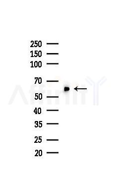 G6PD Recombinant Rabbit mAb - Western blot analysis of lysates from COLO205 cells(heat-shock,45min treatment), using Glucose 6 Phosphate Dehydrogenase Recombinant Rabbit mAb at 1/1000 dilution.