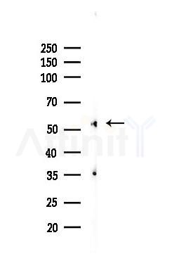 G6PD Recombinant Rabbit mAb - Western blot analysis of lysates from Rat kidney, using Glucose 6 Phosphate Dehydrogenase Recombinant Rabbit mAb at 1/1000 dilution.
