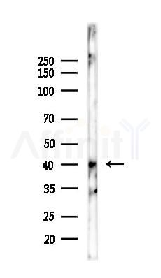 TSG6 Recombinant Rabbit mAb - Western blot analysis of lysates from EC304 cells(heat-shock,45min treatment), using TNFAIP6 Recombinant Rabbit mAb at 1/1000 dilution.
