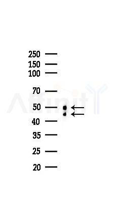 GSK3 alpha/ beta Recombinant Rabbit mAb - Western blot analysis of lysates from HUVEC cells(LPS,4h treatment), using GSK3 alpha/beta Recombinant Rabbit mAb at 1/1000 dilution.