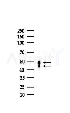 GSK3 alpha/ beta Recombinant Rabbit mAb - Western blot analysis of lysates from COLO205 cells(heat-shock,45min treatment), using GSK3 alpha/beta Recombinant Rabbit mAb at 1/1000 dilution.