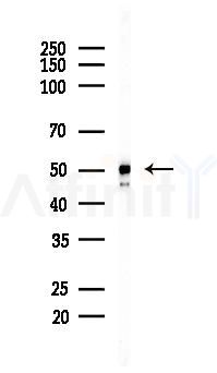 Phospho-GSK3 (alpha/beta) (Tyr279/Tyr216) Recombinant Rabbit mAb - Western blot analysis of lysates from COLO205 cells(heat-shock, 45min treatment), using Phospho-GSK3 (alpha/beta) (Tyr279/Tyr216) Recombinant Rabbit mAb at 1/1000 dilution.