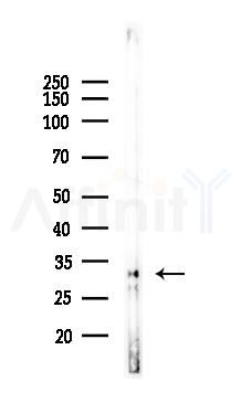 ADIPOQ Recombinant Rabbit mAb - Western blot analysis of lysates from Hela cells(LPS, 4h treatment), using Adiponectin Recombinant Rabbit mAb at 1/1000 dilution.