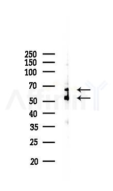 PFKFB3 Recombinant Rabbit mAb - Western blot analysis of lysates from COLO205 cells(LPS, 4h treatment), using PFKFB3 Recombinant Rabbit mAb at 1/1000 dilution.
