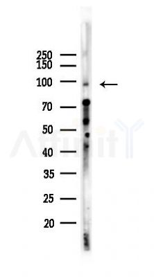 Blimp-1 Recombinant Rabbit mAb - Western blot analysis of lysates from Mouse brain, using PRDM1/Blimp1 Rabbit mAb at 1/1000 dilution.