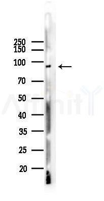 Blimp-1 Recombinant Rabbit mAb - Western blot analysis of lysates from B16F10-LUC cells(LPS,4h treatment), using PRDM1/Blimp1 Rabbit mAb at 1/1000 dilution.