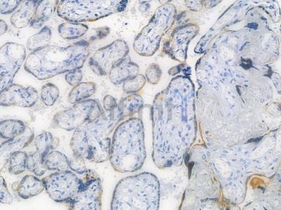 Blimp-1 Recombinant Rabbit mAb - BF3561 at 1/100 staining human normal placenta tissue by IHC-P.