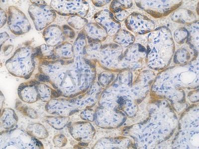Blimp-1 Recombinant Rabbit mAb - BF3561 at 1/100 staining human normal placenta tissue by IHC-P.