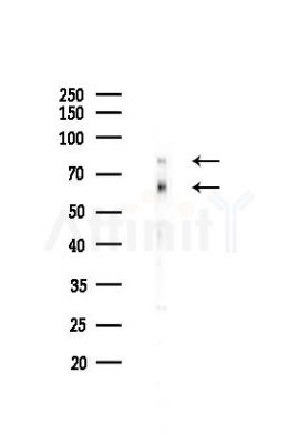 IRAK1 Recombinant Rabbit mAb - Western blot analysis of lysates from Mouse liver, using IRAK1 Recombinant Rabbit mAb at 1/1000 dilution.