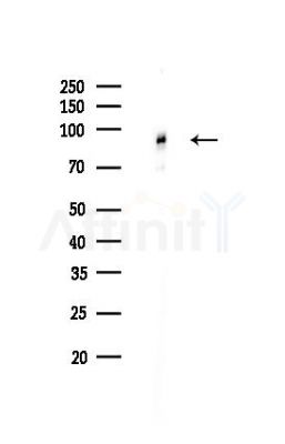 IRAK1 Recombinant Rabbit mAb - Western blot analysis of lysates from Hela cells(LPS,4h treatment), using IRAK1 Recombinant Rabbit mAb at 1/1000 dilution.