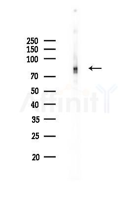 IRAK1 Recombinant Rabbit mAb - Western blot analysis of lysates from B16F10-LUC cells(LPS,4h treatment), using IRAK1 Recombinant Rabbit mAb at 1/1000 dilution.
