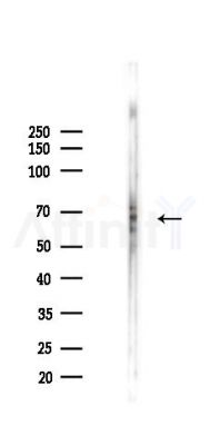 Netrin-1 Recombinant Rabbit mAb - Western blot analysis of lysates from EC304 cells(starvation 24h treatment), using Netrin 1 Recombinant Rabbit mAb at 1/1000 dilution.
