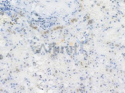 BMP4 Recombinant Rabbit mAb - BF3572 at 1/100 staining human normal lung tissue by IHC-P.