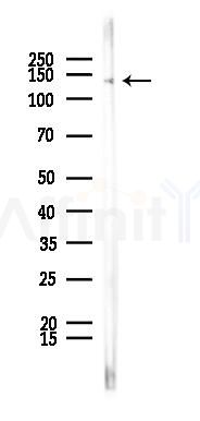 PLCG1 Recombinant Rabbit mAb - Western blot analysis of lysates from LoVo cells(heat-shock,45min treatment), using Phospholipase C gamma 1 Recombinant Rabbit mAb at 1/1000 dilution.
