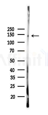 PLCG1 Recombinant Rabbit mAb - Western blot analysis of lysates from B16F10-LUC cells(heat-shock,45min treatment), using Phospholipase C gamma 1 Recombinant Rabbit mAb at 1/1000 dilution.