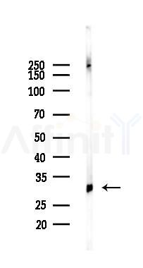 RPS6 Recombinant Rabbit mAb - Western blot analysis of lysates from A375 cells(heat-shock,45min treatment), using RPS6 Recombinant Rabbit mAb at 1/1000 dilution.