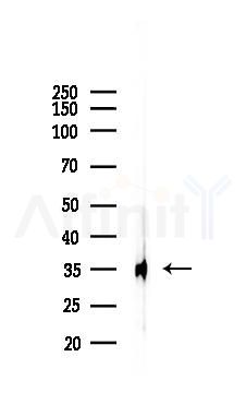 Phospho-RPS6 (Ser240/Ser244) Recombinant Rabbit mAb - Western blot analysis of lysates from Hela cells(LPS, 4h treatment), using Phospho-RPS6 (Ser240/Ser244) Recombinant Rabbit mAb at 1/1000 dilution.