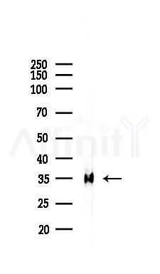 Phospho-RPS6 (Ser240/Ser244) Recombinant Rabbit mAb - Western blot analysis of lysates from PC12 cells(LPS, 4h treatment), using Phospho-RPS6 (Ser240/Ser244) Recombinant Rabbit mAb at 1/1000 dilution.