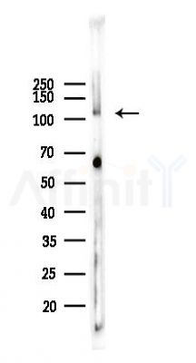 NRP1 Recombinant Rabbit mAb - Western blot analysis of lysates from Mouse brain, using Neuropilin 1 Rabbit mAb at 1/1000 dilution.