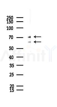 Lamin A/C Recombinant Rabbit mAb - Western blot analysis of lysates from LoVo cells(heat-shock,45min treatment), using Lamin A/C Recombinant Rabbit mAb at 1/1000 dilution.