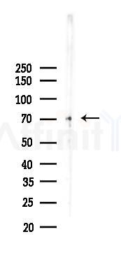 Lamin A/C Recombinant Rabbit mAb - Western blot analysis of lysates from B16F10-LUC cells(heat-shock,45min treatment), using Lamin A/C Recombinant Rabbit mAb at 1/1000 dilution.