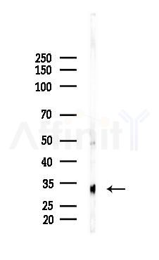 CRH Recombinant Rabbit mAb - Western blot analysis of lysates from Rat liver, using CRF Recombinant Rabbit mAb at 1/1000 dilution.