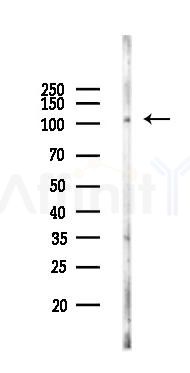 CD41 Recombinant Rabbit mAb - Western blot analysis of lysates from EC304 cells(starvation 24h treatment), using CD41 Recombinant Rabbit mAb at 1/1000 dilution.