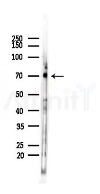 Cytochrome P450 27A1 Recombinant Rabbit mAb - Western blot analysis of lysates from Mouse testis, using CYP27A1 Recombinant Rabbit mAb at 1/1000 dilution.