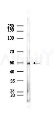 Cytochrome P450 27A1 Recombinant Rabbit mAb - Western blot analysis of lysates from Rat testis, using CYP27A1 Recombinant Rabbit mAb at 1/1000 dilution.