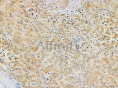 Cytochrome P450 27A1 Recombinant Rabbit mAb - BF3588 at 1/100 staining human normal liver tissue by IHC-P.