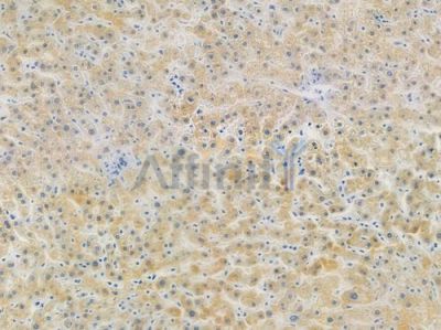 Cytochrome P450 27A1 Recombinant Rabbit mAb - BF3588 at 1/100 staining human normal liver tissue by IHC-P.