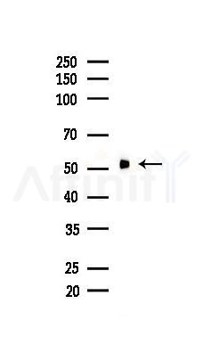 TRAF2 Recombinant Rabbit mAb - Western blot analysis of lysates from HUVEC cells(LPS,4h treatment), using TRAF2 Recombinant Rabbit mAb at 1/1000 dilution.