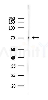 DRD1 Recombinant Rabbit mAb - Western blot analysis of lysates from Mouse liver, using Dopamine Receptor D1 Recombinant Rabbit mAb at 1/1000 dilution.