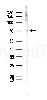 DRD1 Recombinant Rabbit mAb - Western blot analysis of lysates from LoVo cells(heat-shock,45min treatment), using Dopamine Receptor D1 Recombinant Rabbit mAb at 1/1000 dilution.