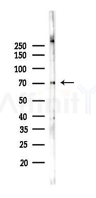DRD1 Recombinant Rabbit mAb - Western blot analysis of lysates from B16F10-LUC cells(heat-shock,45min treatment), using Dopamine Receptor D1 Recombinant Rabbit mAb at 1/1000 dilution.