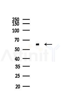 HDAC2 Recombinant Rabbit mAb - Western blot analysis of lysates from LoVo cells(heat-shock,45min treatment), using HDAC2 Recombinant Rabbit mAb at 1/1000 dilution.