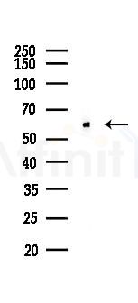 HDAC2 Recombinant Rabbit mAb - Western blot analysis of lysates from EC304 cells(LPS, 4h treatment), using HDAC2 Recombinant Rabbit mAb at 1/1000 dilution.