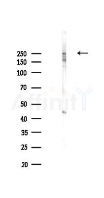 ACACB Recombinant Rabbit mAb - Western blot analysis of lysates from PC12 cells(LPS 4h treatment), using Acetyl Coenzyme A Carboxylase Recombinant Rabbit mAb at 1/1000 dilution.